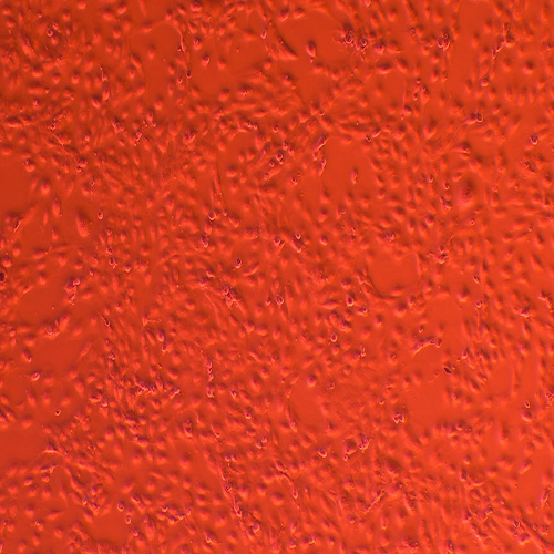 MET-5A人膜间皮细胞（STR鉴定正确）