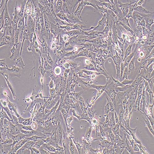 MG-63人骨肉瘤细胞（STR鉴定正确）