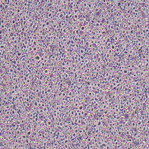 MM.1S人IgA-骨髓瘤细胞（STR鉴定正确）