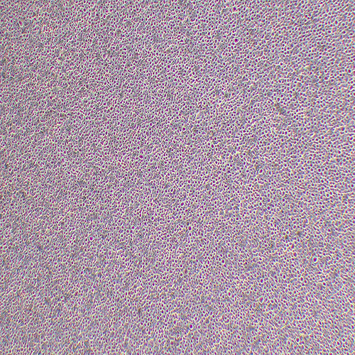 MM.1S人IgA-骨髓瘤细胞（STR鉴定正确）