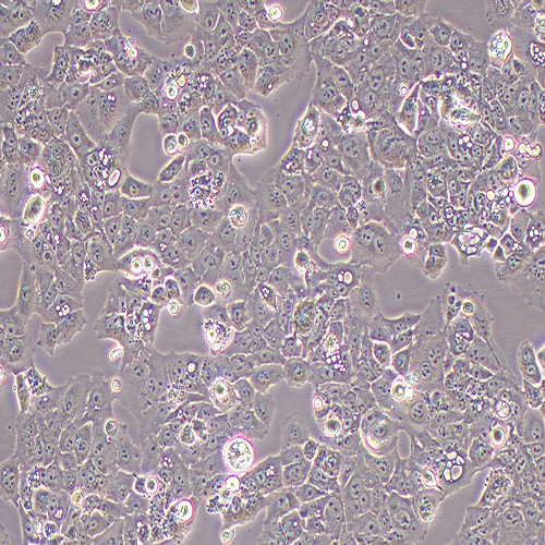 MS751人子宫颈表皮癌细胞（STR鉴定正确）