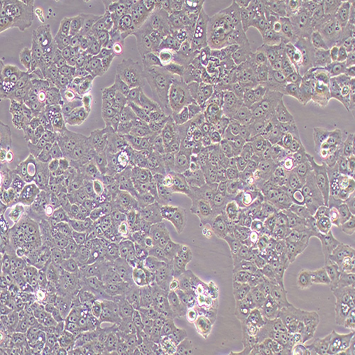 MS751人子宫颈表皮癌细胞（STR鉴定正确）