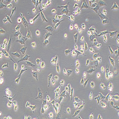 MUM2B人侵袭性脉络膜黑色素瘤细胞（STR鉴定正确）