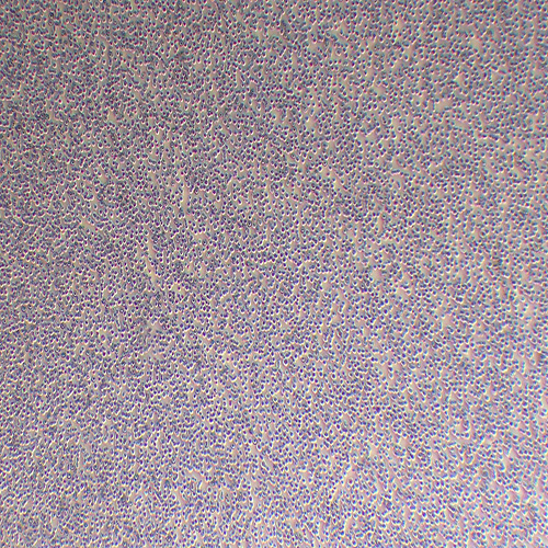 MV-4-11人髓性单核细胞白血病细胞