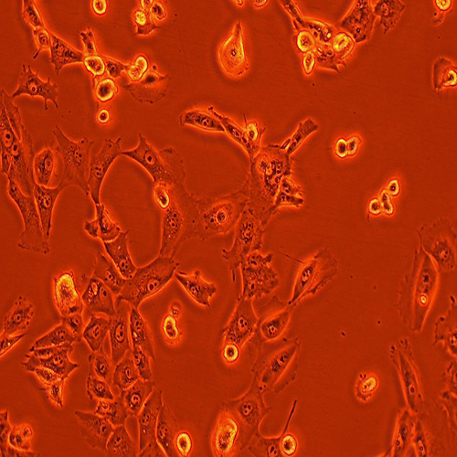 NCI-H226人肺鳞癌细胞（STR鉴定正确）