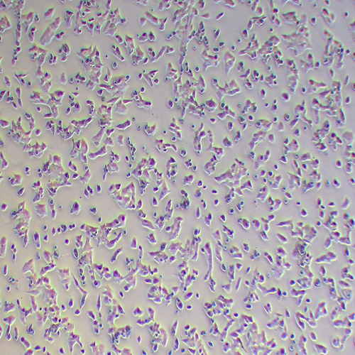 NCI-H295R人肾上腺皮质腺癌细胞