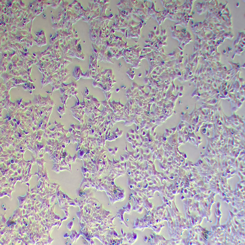 NCI-H322人支气管肺泡癌细胞
