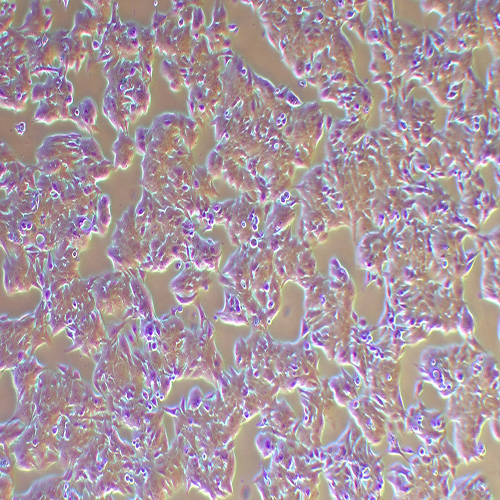 NCI-H358人非小细胞肺癌细胞（STR鉴定正确）