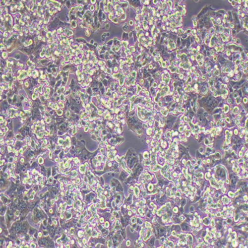 NCI-H520人肺鳞癌细胞（STR鉴定正确）