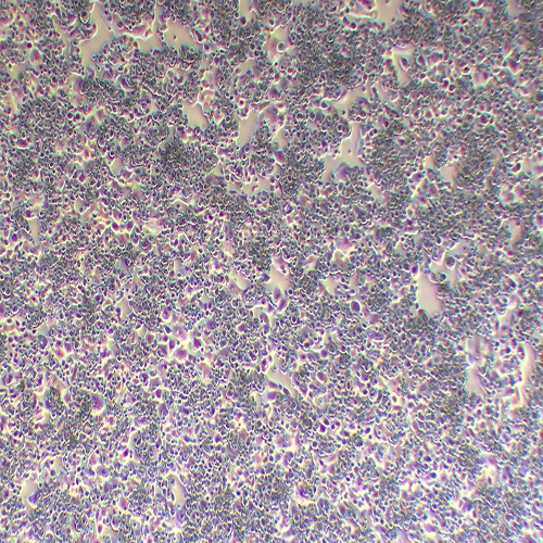 NCI-H520人肺鳞癌细胞（STR鉴定正确）