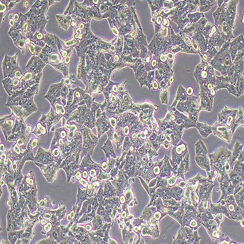 NCI-H1395人肺腺癌细胞（STR鉴定正确）