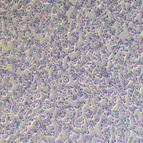 NCI-H1395人肺腺癌细胞（STR鉴定正确）