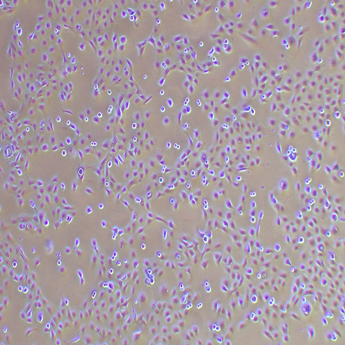 NCI-H1650人非小细胞肺癌细胞（STR鉴定正确）