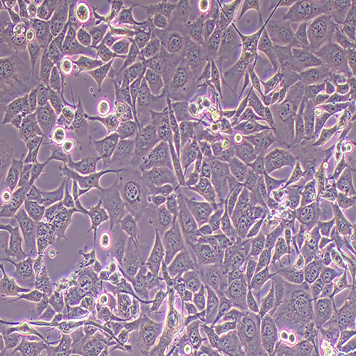 NCI-H1975人肺腺癌细胞（STR鉴定正确）