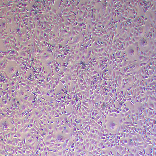 NCI-H1975人肺腺癌细胞（STR鉴定正确）