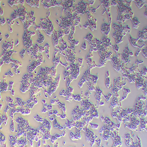 NCI-N87人胃癌细胞（STR鉴定正确）