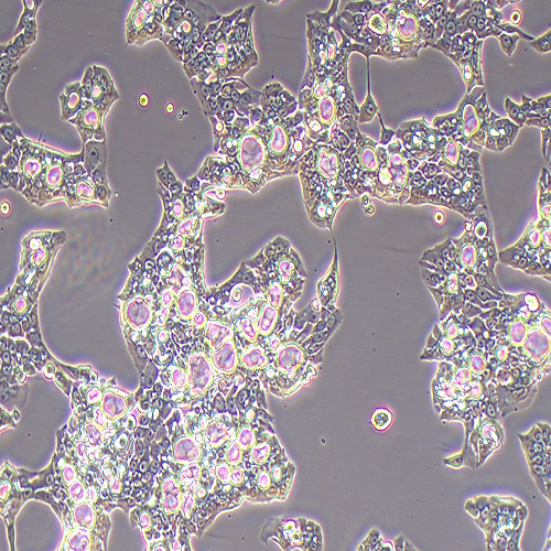 NCI-N87人胃癌细胞（STR鉴定正确）