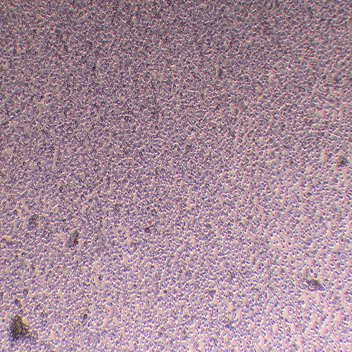 NK-92人恶性非霍奇金淋巴瘤患者的自然杀伤细胞（STR鉴定正确）