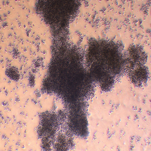 NK-92MI（人恶性非霍奇金淋巴瘤患者的自然杀伤细胞）(STR鉴定正确)