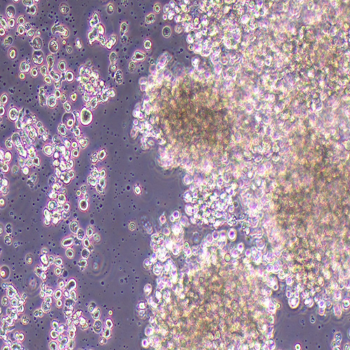NK-92MI（人恶性非霍奇金淋巴瘤患者的自然杀伤细胞）(STR鉴定正确)