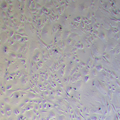 OS-RC-2人肾癌细胞（STR鉴定正确）