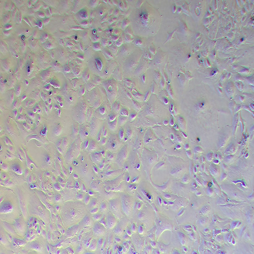 OS-RC-2人肾癌细胞（STR鉴定正确）