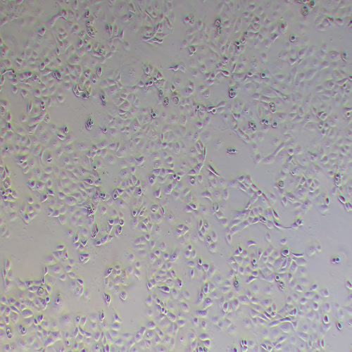 OVCAR-3人卵巢腺癌细胞（STR鉴定正确）