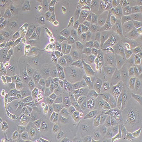 OVCAR-3人卵巢腺癌细胞（STR鉴定正确）
