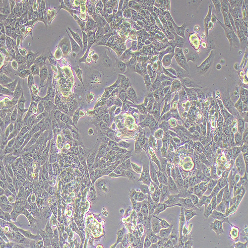 NIH:OVCAR-8 人卵巢癌腺癌细胞