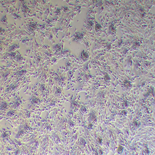 NIH:OVCAR-8 人卵巢癌腺癌细胞