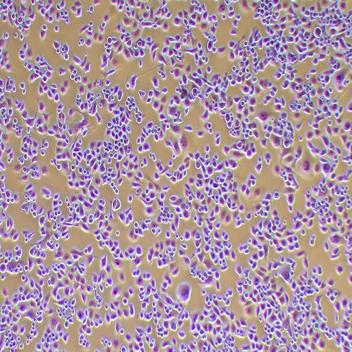 PANC-1人胰腺癌细胞（STR鉴定正确）