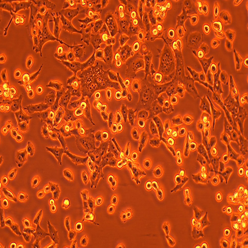 PATU 8988S人胰腺癌细胞（STR鉴定正确）