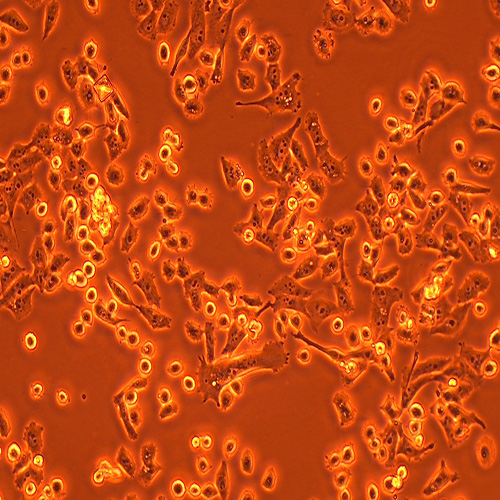 PATU 8988S人胰腺癌细胞（STR鉴定正确）