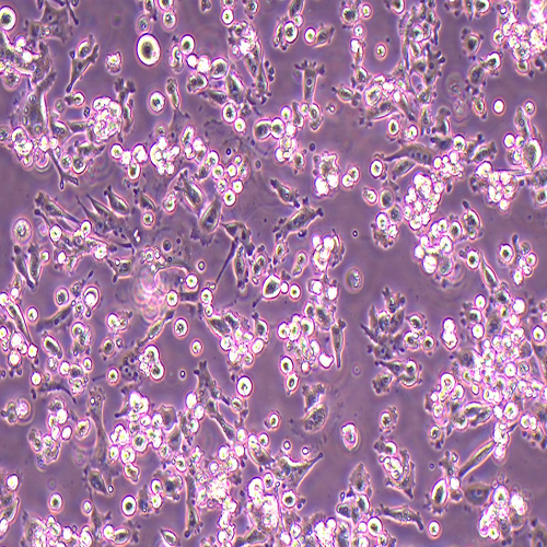 PATU 8988t人胰腺癌细胞（STR鉴定正确）