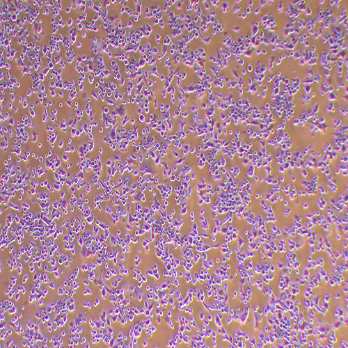 PATU 8988t人胰腺癌细胞（STR鉴定正确）