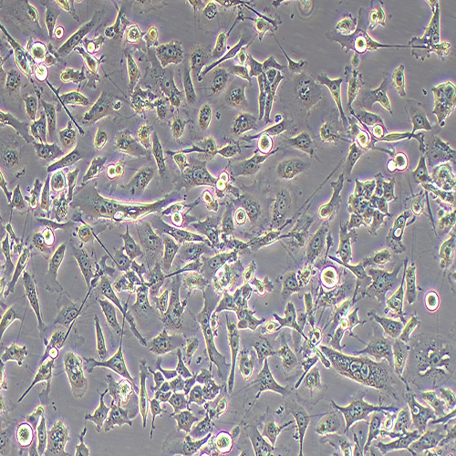PC-3人前列腺癌细胞（STR鉴定正确）