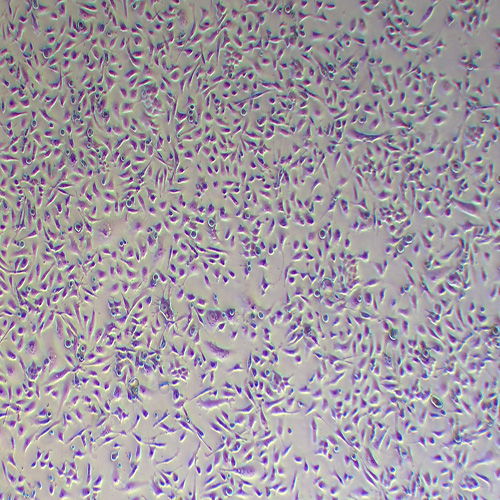 PC-3人前列腺癌细胞（STR鉴定正确）