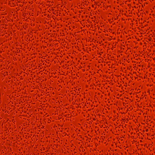 RD人恶性胚胎横纹肌瘤细胞（STR鉴定正确）