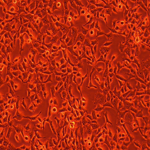 RD人恶性胚胎横纹肌瘤细胞（STR鉴定正确）