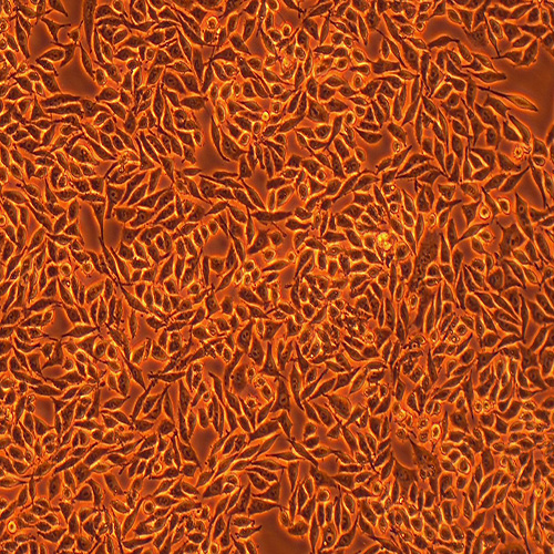 RKO人结肠腺癌细胞（STR鉴定正确）