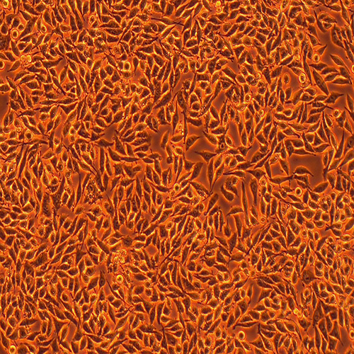 RKO人结肠腺癌细胞（STR鉴定正确）