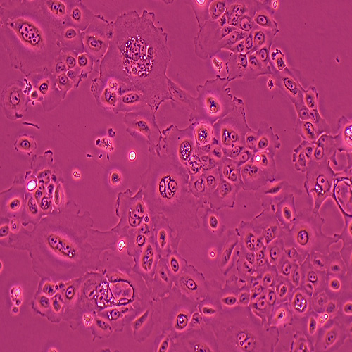 RWPE-1人正常前列腺上皮细胞（STR鉴定正确）