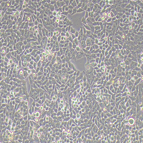 RWPE-2人前列腺正常细胞（STR鉴定正确）