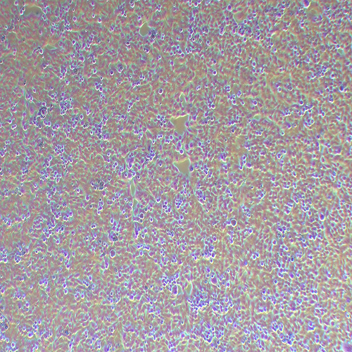 RWPE-2人前列腺正常细胞（STR鉴定正确）