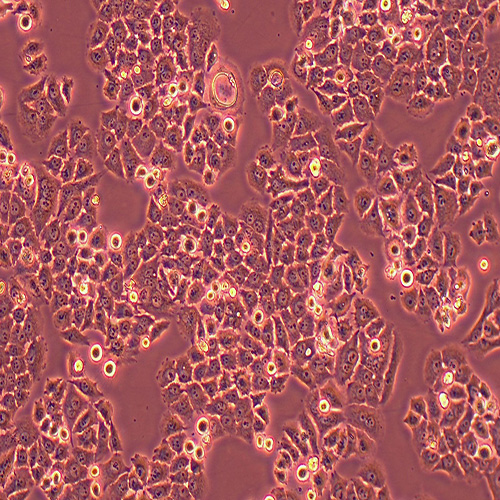 SBC-2人小细胞肺癌细胞（STR鉴定正确）