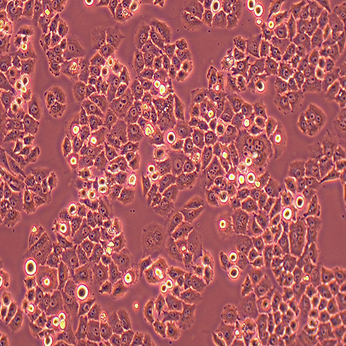 SBC-2人小细胞肺癌细胞（STR鉴定正确）