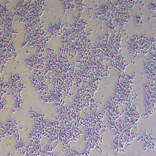 SH-SY5Y人神经母细胞瘤细胞（STR鉴定正确）