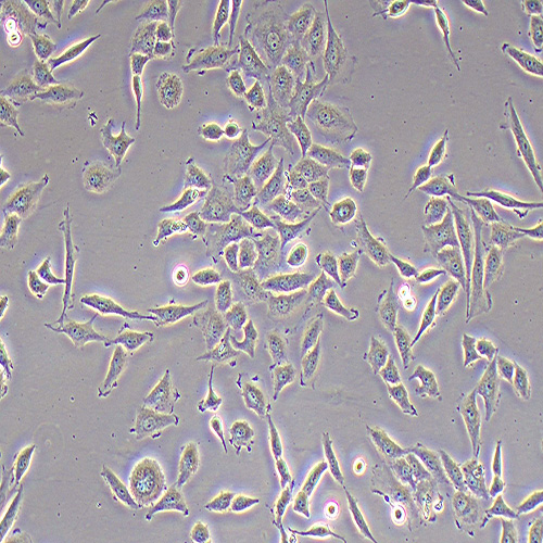 SiHa人子宫颈鳞癌细胞（STR鉴定正确）