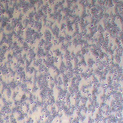 SK-BR-3人乳腺腺癌细胞（STR鉴定正确）