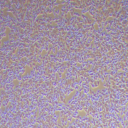 SK-MEL-2人皮肤黑色素瘤细胞（STR鉴定正确）